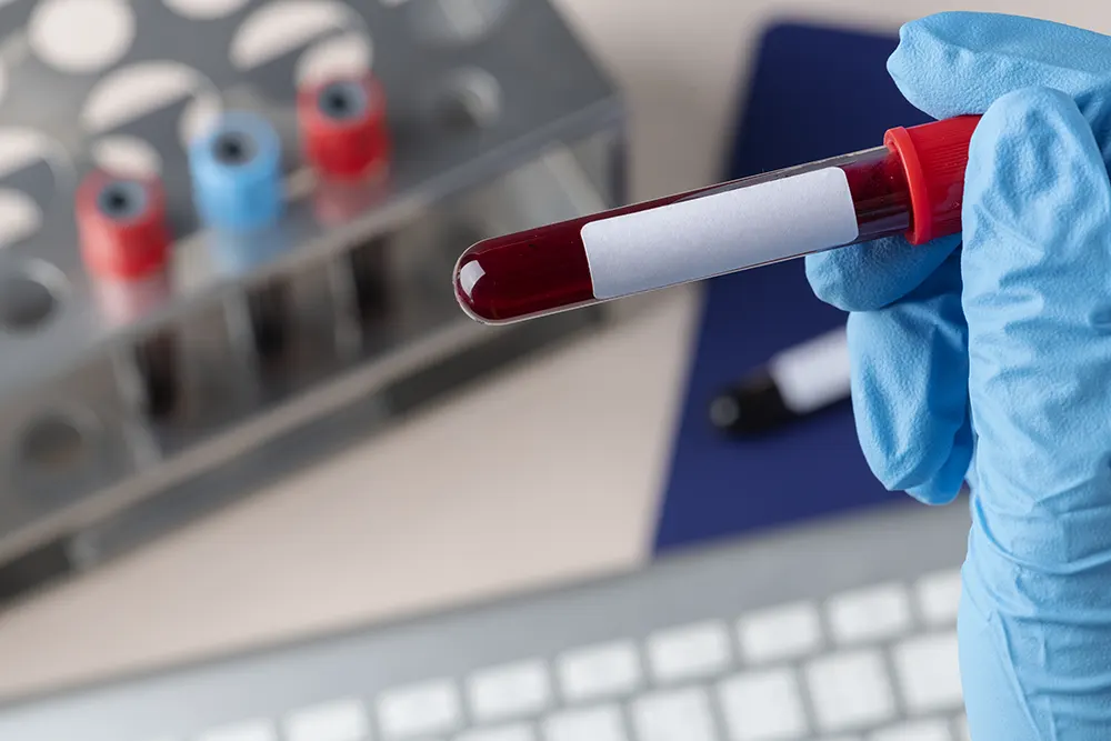 test sangue e screening voss